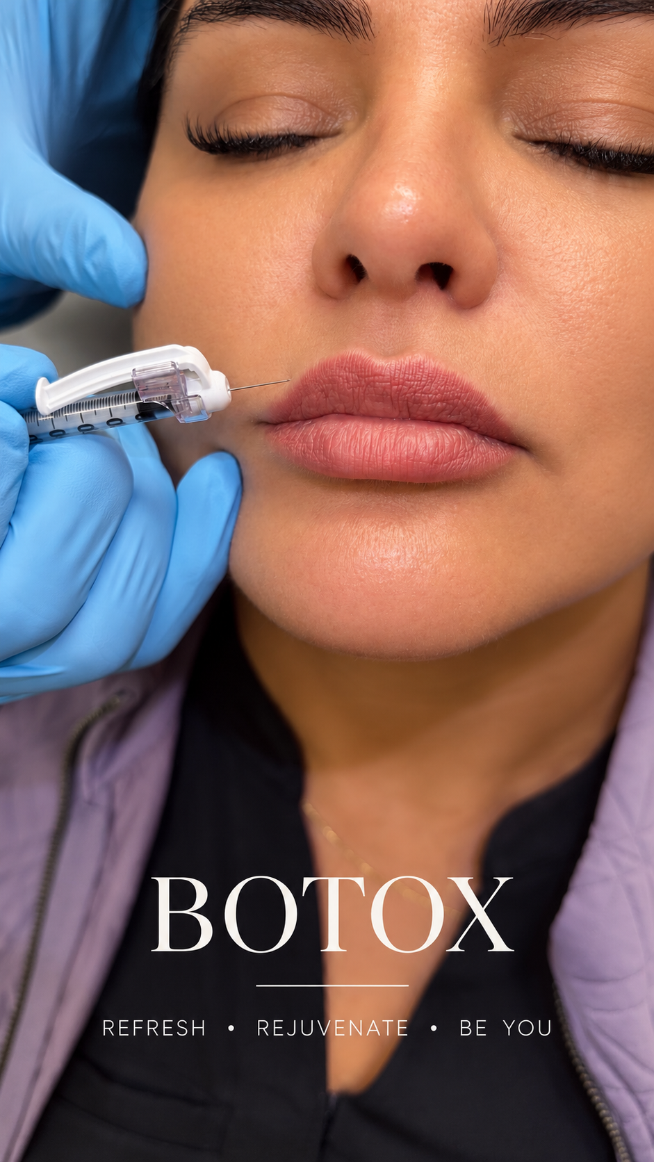 Subtle Lip Flip & Perioral Care